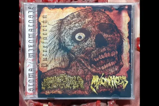 STOMA / MIXOMATOSIS - Putrefaccion Split CD
