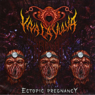 VIVA LA VULVA - Ectopic Pregnancy CD